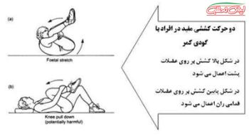 حرکات اصلاحی گودی کمر،کاهش گودی کمر،قوس کمر،لوردوز،حرکات درمانی قوس کمر،مقاله ورزشی