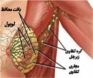 سرطان سینه, بیماری زنان, درمان سرطان سینه