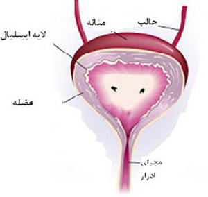 علائم التهاب مثانه التهاب مثانه, درمان التهاب مثانه,مثانه