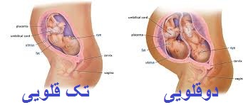 بارداری