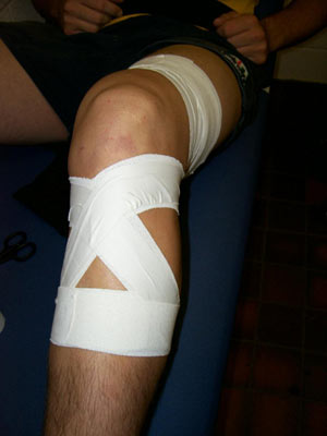  چگونه درد زانو را درمان کنیم