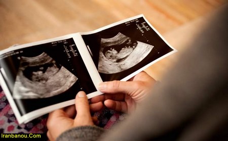 سونوگرافی آنومالی در هفته 16